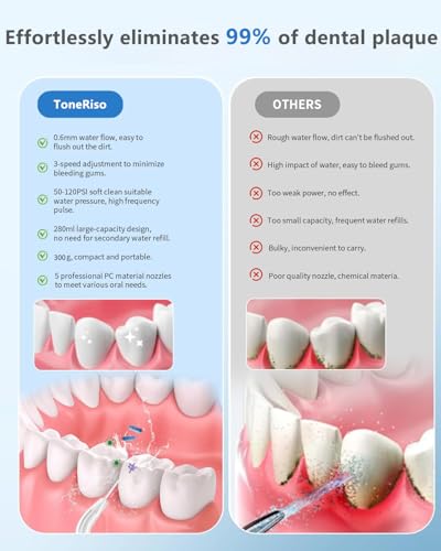 Elektrische Wasserseide, tragbarer Zahnreiniger, kabelloser Wasserflosser für die Zahnreinigung, 280 ml Wassertank, Zahnseide mit 5 Düsen, 3 Modi, geeignet für Zuhause und Reisen, Weiß – Bild 4
