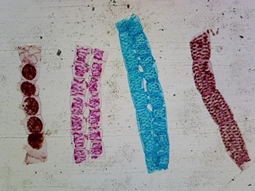 Chlorophyta, Spirogyra, and Scalariform Conjugation - Microscope Slide