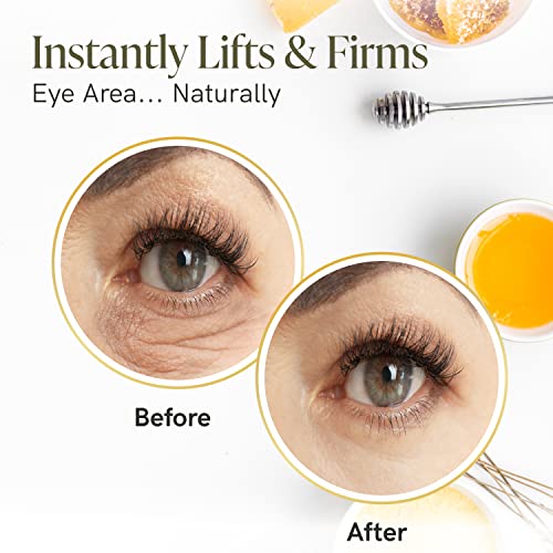 Bee Rx Anti-Aging Eye Lift Roller With Kanuka Honey - Instant Firming Eye Cream For Wrinkles, Fine Line Under Eye Serum #TOP4