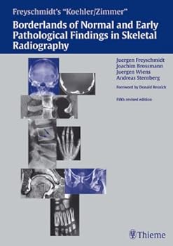 Hardcover Borderlands of normal and early pathologic findings in skeletal radiography Book