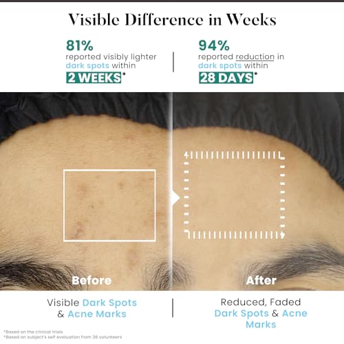 Image of Bio Code 2% Tranexamic Acid & 5% Vitamin C Radiance Renewal Serum (30ml) - with 3% Niacinamide, 1.5% Hyaluronic Acid & 0.5% Vitamin E | Dermatologist Recommended