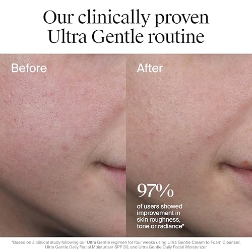 Neutrogena Ultra Gentle Daily Facial Moisturizer, Fragrance-Free, 3.4 fl oz - image 5