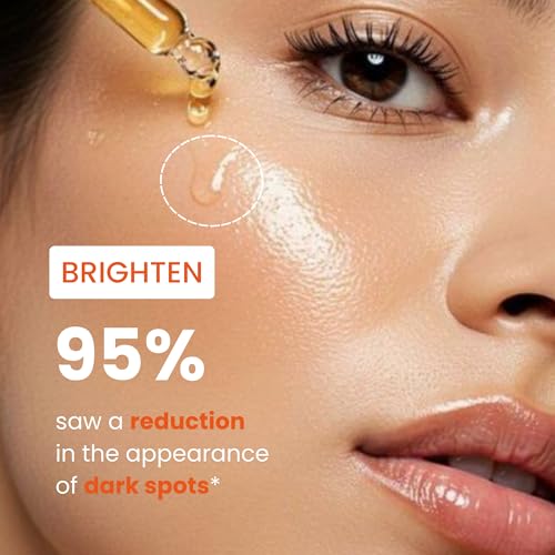 Image of Vitamin C Face Serum with Ascorbic Acid, Lemon & Amla | Brightening Serum for Dark Spots, Pigmentation & Uneven Skin Tone | 30 ml
