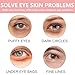30 Pairs Eye Masks & Lip Masks,Under Eye Patches for Puffy Eyes,Pink Moisturizing Spa Daily Labial Lip Masks,Bachelorette Party Favors,Hangover Kit,Bulk Gifts for Women,Reduce Fine Lines,Skincare
