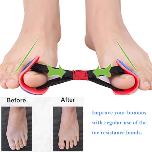 Image of Toe Resistance Bands, Toe Bands for Bunions, Big Toe Strap Bunion Straightener Stretchy Belt, Bunion Corrector Strap, Toe Bunion Stretcher, Bunion Realignment Strap Corrector Foot Pain Relief