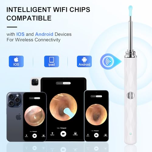 Image of High-Definition Ear Wax Removal, Wireless Ear Cleaner, Safe and Gentle Ear Wax Removal Kit, Rechargeable Ear Cleaner with Camera and Light, Ear Cleaning Kit for Android and iOS (White)