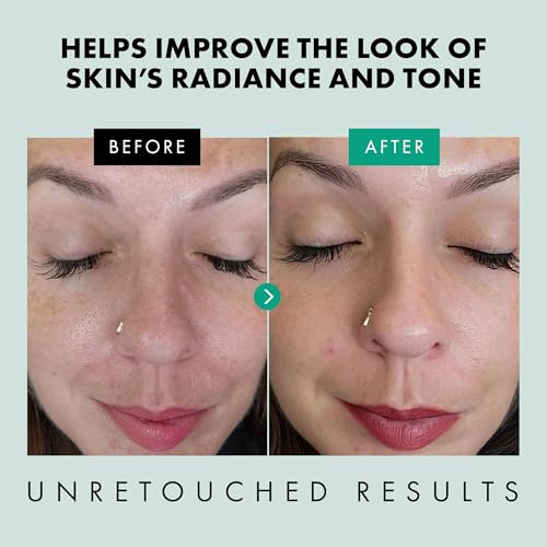 Image of Eclat Skincare Clarifying Niacinamide Serum - 12% Niacinamide with Zinc PCA & Hyaluronic Acid - Hydrating & Soothing Formula - Face Serum for Minimizing Pores and Improving Skin Texture 1 Fl Oz
