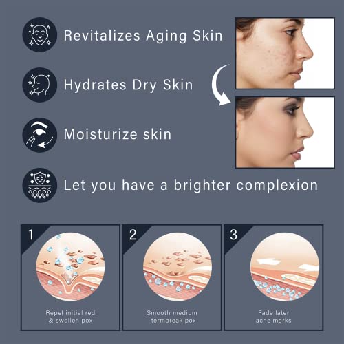 Noamed Snail Mucin 92% Repair Cream 3.52 Oz, Daily Collagen Face Moisturizer For Dry Skin, Sensitive Skin,Reduce Wrinkles, No Parabens, No Sulfates, No Phthalates, Korean Skincare （1Pcs） #TOP3