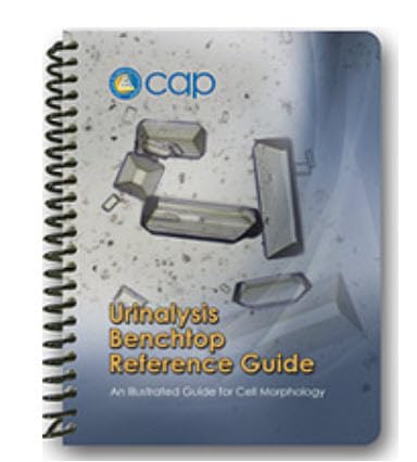 URINALYSIS BENCHTOP REFERENCE GUIDE
