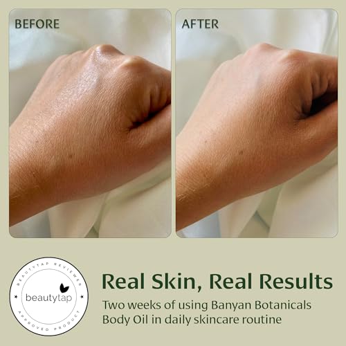 Banyan Botanicals Body Oil – Lightweight & Non-Greasy Body Oil – Ayurvedic Skin Care with Organic Jojoba Oil & Herbs for Soft, Smooth Skin – 4 oz – Non-GMO, Cruelty Free, Paraben Free Massage Oil - Image 5
