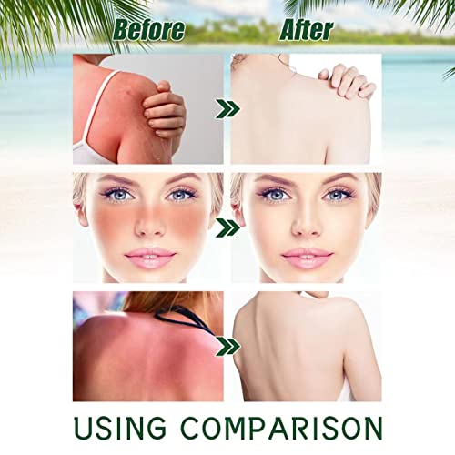 Ouhoe Aloe Vera Sunscreen, Moisturizing Light Refreshing Non-Greasy,Moisturizing Uv,Isolation Sunscreen,Ideal For Bare Skin Care Lovers And Sun Protection Lovers Alike!1Pcs #TOP3