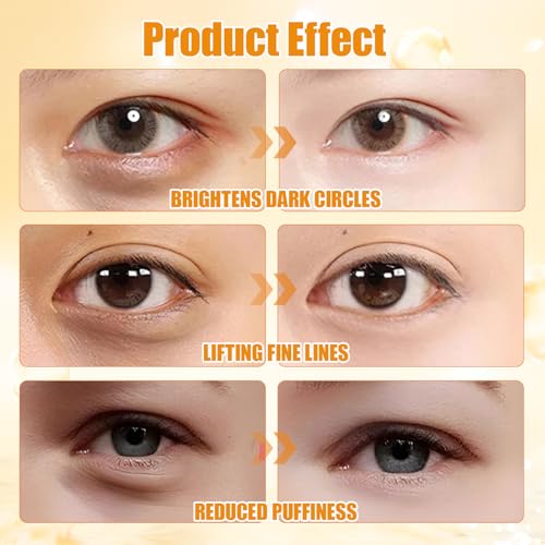 4 Stück Lutein Eye Essence Oil Lutein Anti-Falten Serum öl Lutein Anti-Wrinkle Serum Oil Ruy Eye Oil Vc Vc Augenserum Vc Lutein Anti Falten öl Vc Lutein Eye Essence Oil Lutein Eye Essence Oil 8ml