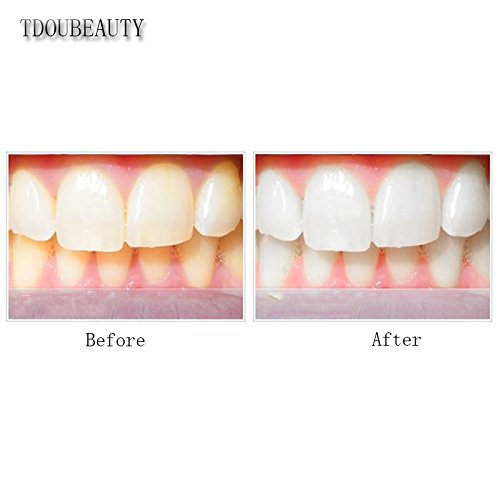 10 Pcs Bulbs Blue Led Lamp Teeth Whitening Machine Laser Dental Equipment Tooth Whitening System