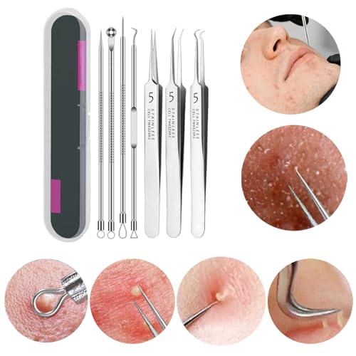 Lonwiner Pickel Werkzeug Set, Komedonenquetscher Mitesser Pinzette Mitesserentferner Tweezers Pickel Ausdrücken Werkzeug Milien entferner