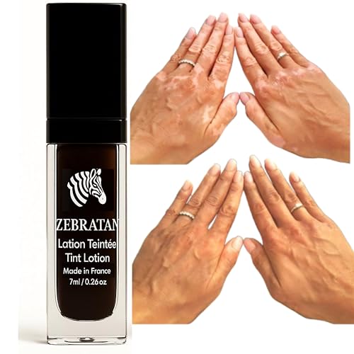 Trucco vitiligine su misura Zebratan - 7ml Beige Marrone - Lozione autoabbronzante - non grassa, non un fondotinta - mimetico piastre
