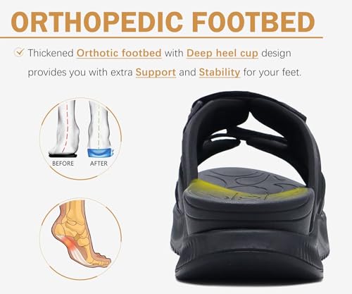 Image of ONCAI Womens Orthotic Sandals Ladies Recovery Walking Slides Arch Support Plantar Fasciitis Comfort Orthopedic Soft Cushion Summer Adjustable Sandalias Size 6-12