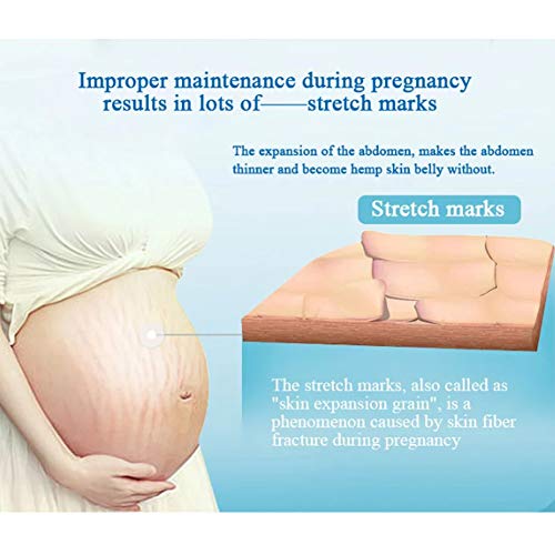 DYWOZDP Ceinture de maternité, Soutien Grossesse, Ceinture de Levage de l'estomac Femme Enceinte, Matériel Respirant Ascenseurs et Supports, pour soulager Le Dos, la Douleur Hanche – vue 7
