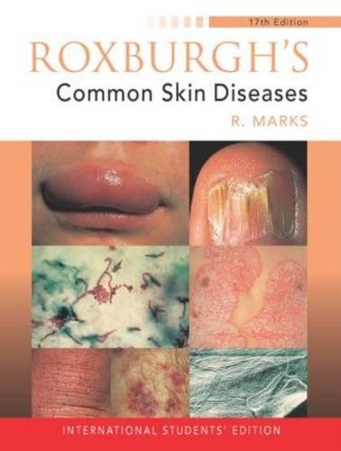 (EX)(OLD)ROXBURGH'S COMMON SKIN DISEASES