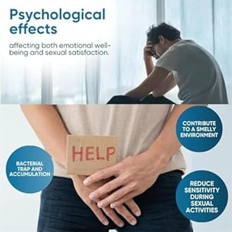 BruteCo Redundant Prepuce Corrector Gel,Natural Ingredients Phimosis Foreskin Correction Gel,Correction Gel for Excessive Foreskin,Fast and Gentle Action (2pcs)