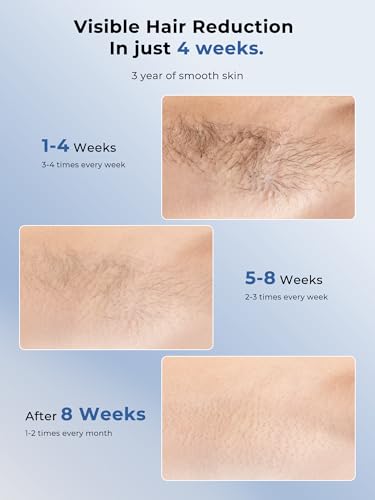 Image of Ubroo Laser Hair Removal with 5℃ Ice Cooling,Hand-held Hair Removal Device IPL Hair Removal for Women and Men,Reduce Hair Regrowth,Full Body Use for Legs,Bikini,Armpits（Blue）