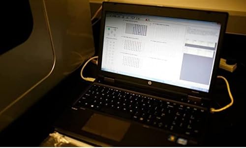 Watsondna - My Alzheimer Test - Test For Apoe E4 Gene And Alzheimer's Risk; Performed At-Home #TOP3