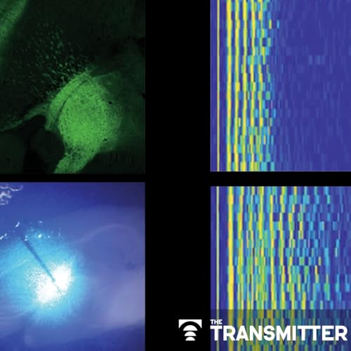 Sensory gatekeeper drives seizures, autism-like behaviors in mouse model Podcast Por capa