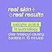 Dermalogica Clear Start Breakout Clearing Booster (1 Fl Oz) Acne Spot Treatment with Salicylic Acid - Clears Breakouts & Locks in Moisture To Soothe Irritation