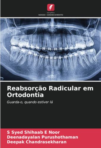 Reabsorção Radicular em Ortodontia: Guarda-o, quando estiver lá