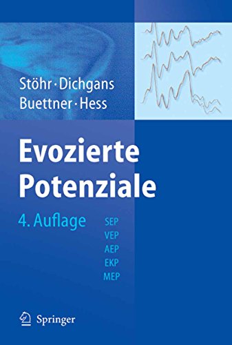 Evozierte Potenziale: SEP - VEP - AEP - EKP - MEP