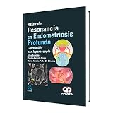 Atlas de Resonancia en Endometriosis Profunda