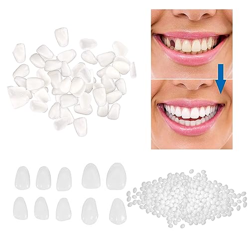 How To Take Care Of Your Teeth After Having Dental Veneers