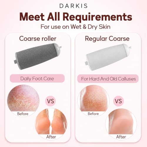 Image of DARKIS Callus remover for feet, dead skin remover electronic pedicure tools | Perfect foot scrubber and cleaner machine (Pink)