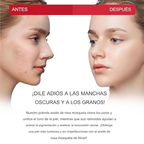 Aceites, Imagen adicional