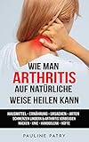 Wie man Arthritis auf natürliche Weise heilen kann: Hausmittel - Ernährung - Ursachen - Arten | Schmerzen lindern & Arthritis vorbeugen | Nacken - Knie ... - Fibromyalgie - Sehnenentzündung)