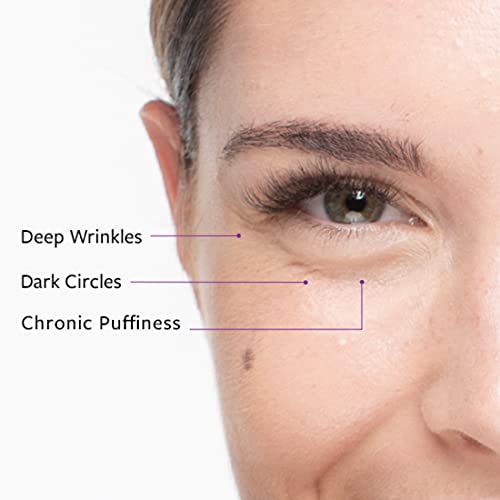 Freezeframe occhi rivitali