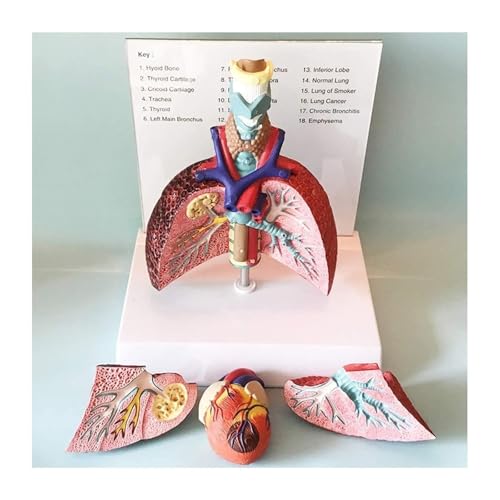 Cœur et larynx AMITD taille réelle pour comprendre les maladies facilement - 6