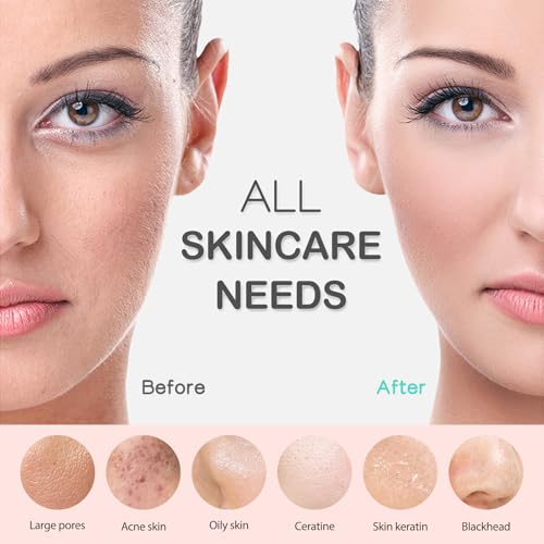 PRITECH Silicone Face Scrubber, Rechargeable Facial Cleansing Brush with Heat Massage End, Vibrating Exfoliator Scrubber for Deep Cleaning, Waterproof Face Brush for Women and Men (Green) - Image 6