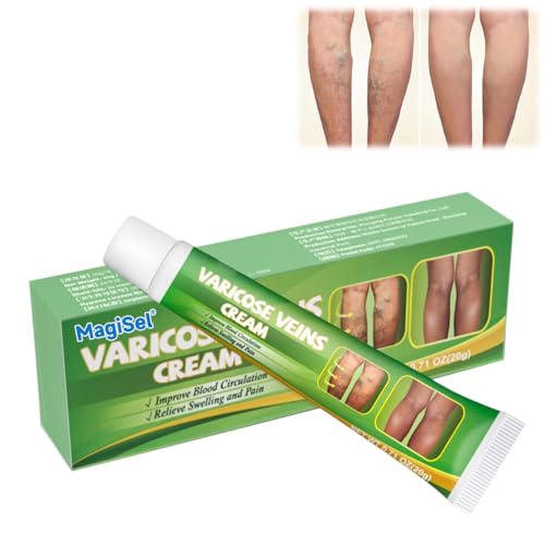 Crema varices, Crema para Eliminar Varices, Crema Tratamiento Venas Varicosas, Varicose veins cream, Crema Eliminación Arañas Vasculares, Alivio para Varices y Arañas Vasculares, 20g