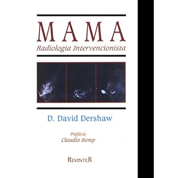 Capa do livro Mama: Radiologia Intervencionista
