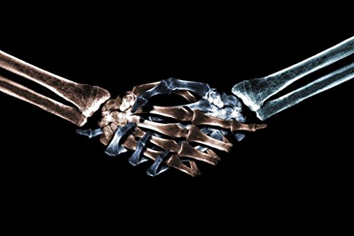 Laminated Handshake Skeletons Shaking Hands XRay Photo Poster X Ray Skeleton Arms Human Body Anatomy Photograph Poster Dry Erase Wall Art 24x16