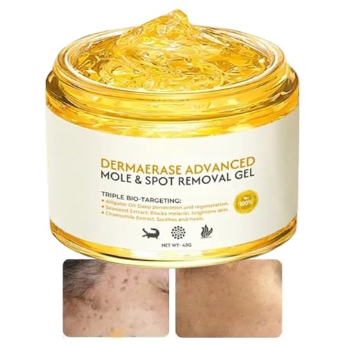Eliminador de Lunares para Rostro | Eliminador de Natural Portátil | Hidratante Corporal para Rostro Manos Cuello en Viaje Mañana y Noche