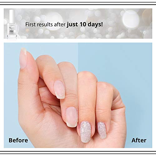 Eveline Cosmetics 8in1 Total Action konzentriertes Nagelpflegemittel mit Silberpartikeln | 12 ml | Restaurative… – Bild 7