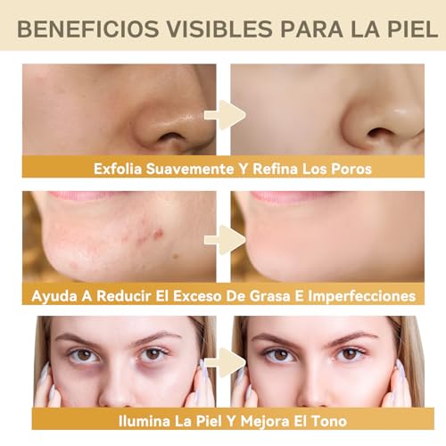 Ácido Glicólico 7% Tónico Facial Exfoliante y Renovador – Glycolic Acid Toning Resurfacing Solution para Manchas y Acné, Suavizante e Hidratante, Apto para Todo Tipo de Piel - imagen 2