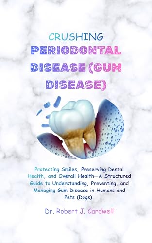CRUSHING PERIODONTAL DISEASE (GUM DISEASE): Protecting Smiles, Preserving Dental Health and Overall Health—A Structured Guide to Understanding, Preventing ... modern science health books Book 7)
