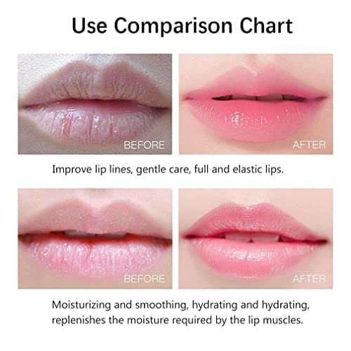 Image of Hydrating Lip Mask,Lip Sleep Mask 20 Pcs Reduces Lines and Restores Moisture, Effectively Nourishes Skin, Gel Treatment Plumping Care Products (Lip Mask-Pink)
