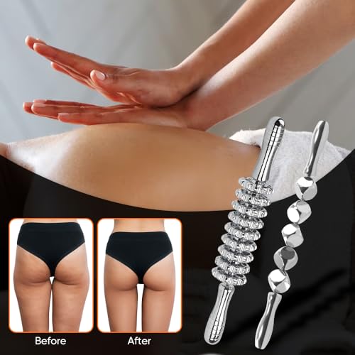 ONUEMP 2pcs Stainless Steel Massage Rollers for Ice Body Sculpting, Maderoterapia Kit Colombiana Professional, Cellulite Massager Roller, Lymphatic Drainage Massager, Cellulite Remover for Leg Back