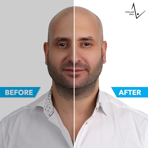 Collar Dots Collar Stays For Men’S Dress Shirts & Polo’S. Fashion Hack For Plastic thumb #5