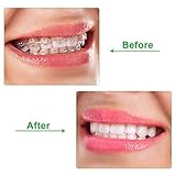 10 Stücke Aligner Chewies für Aligner Chompers Aligner Tablett Sitzer Chewies (Grün)