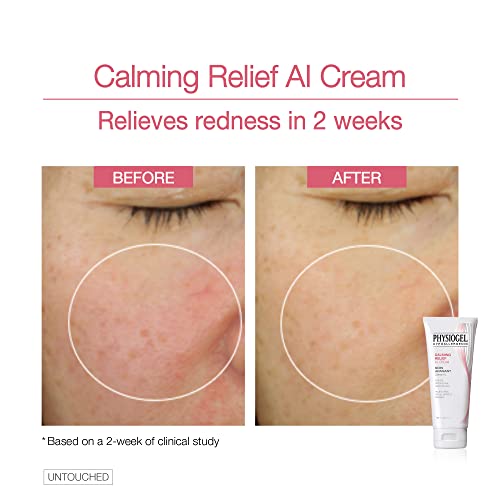Physiogel Calming Relief A.i. Face Cream | Anti-Dryness & Itchiness Ceramide Face Moisturizer For Sensitive, Itchy, Red & Dry Skin | Soothing, Low Irritant Formula, Hypoallergenic | 3.3 Fl. Oz #TOP2