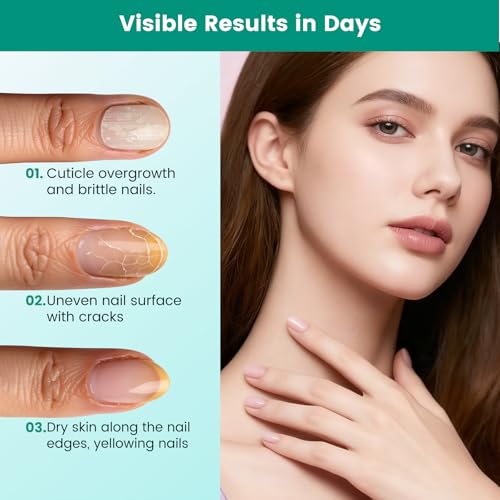 Yokilly 3-in-1 Nagelhautentferner Nagelöl Stift: Keramikspitze Nagelhautschieber Ölstift Cuticle Nail Care Pen - Nagelpflege Stift Nagelhautöl für Nagelhaut die Reparatur von Rissigen und Trockenen